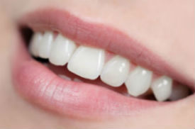 Dental Bonding | Everett Dental Associates | Dentist Peabody, MA